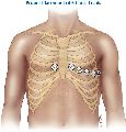 image Chest lead placement